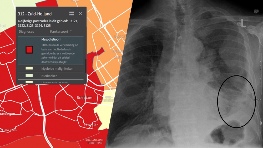Absurd veel asbestkanker in het noorden van Schiedam, maar waarom?